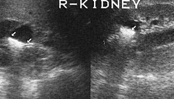 uklad-moczowy-05